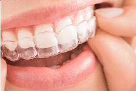 Mouth Guard at E Dental